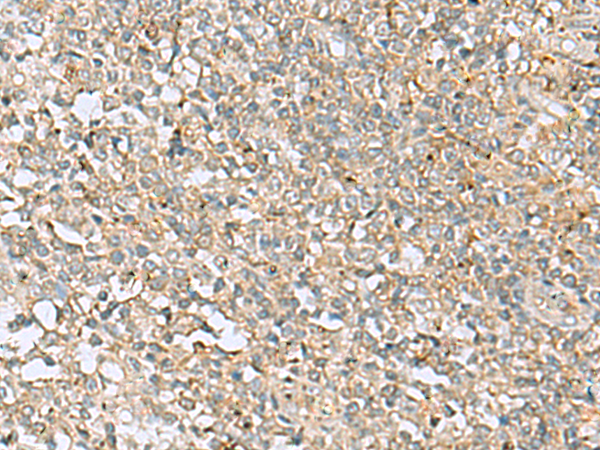 FERMT1 antibody