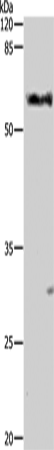 ALDH1A1/ALDH1A2/ALDH1A3 antibody