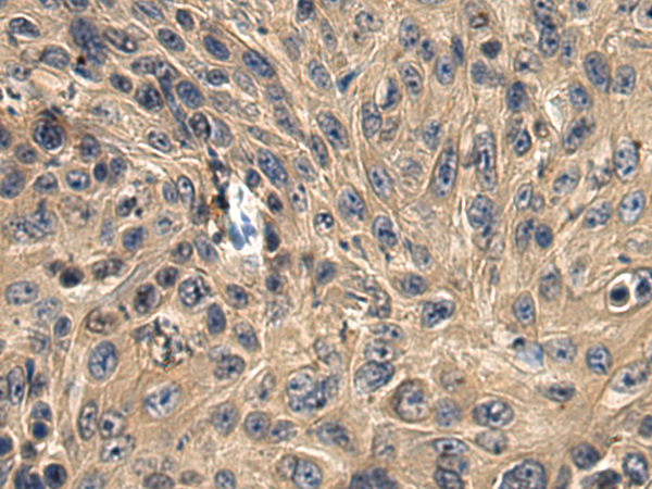 BTNL2 antibody