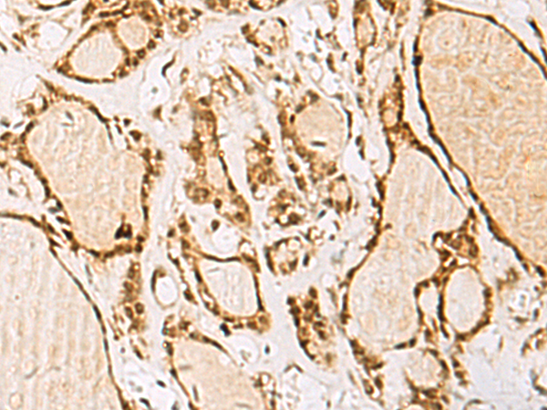 NIPBL antibody