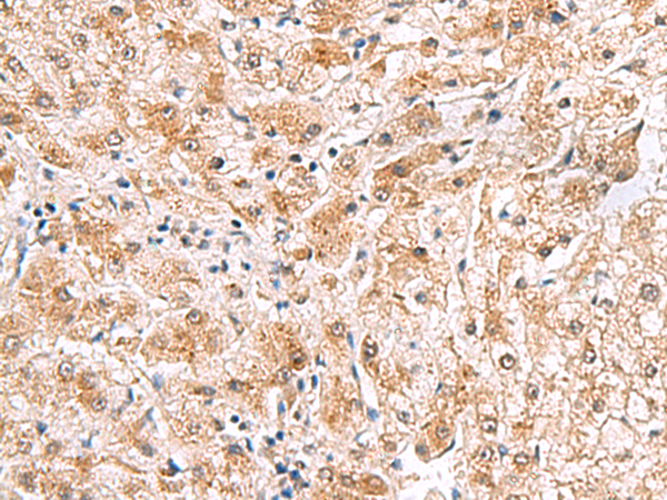PDCL2 antibody