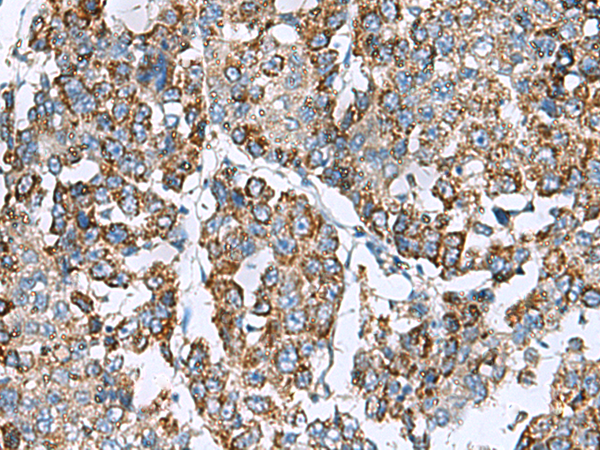 PRELID3B antibody