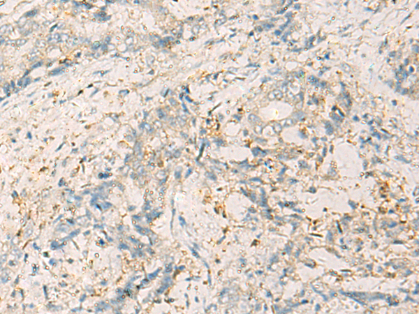 WDR37 antibody