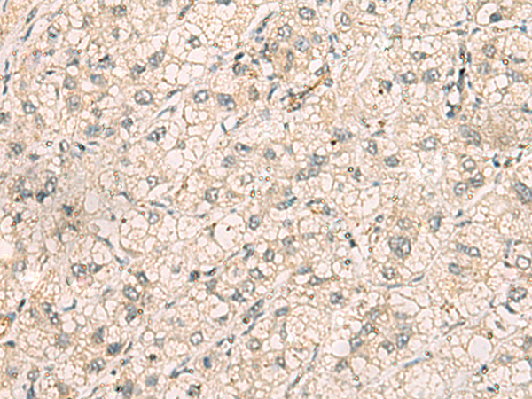 TTLL5 antibody