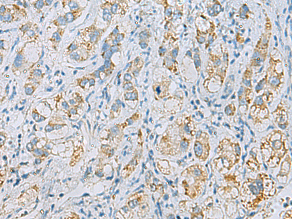 PLA2G15 antibody