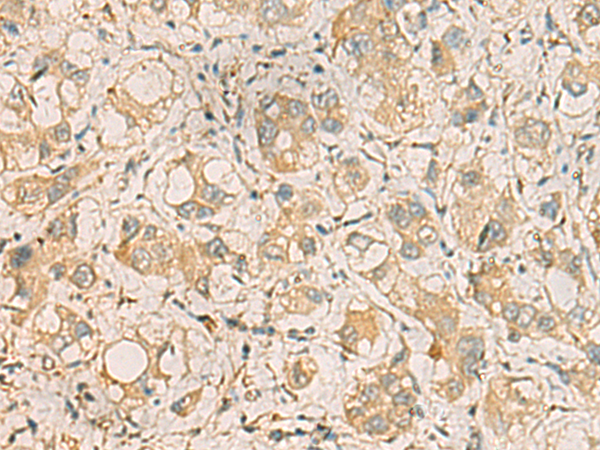 ZDHHC3 antibody