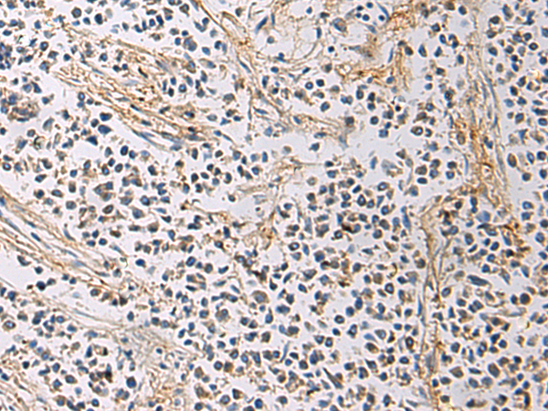 GMPR antibody