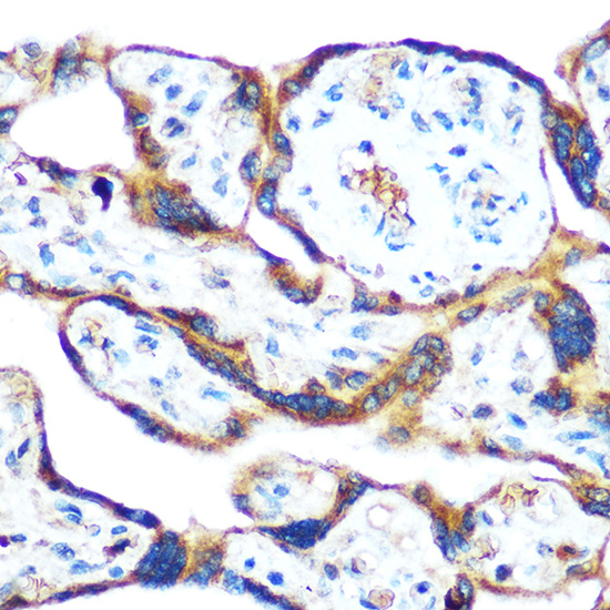 GDF15 Antibody