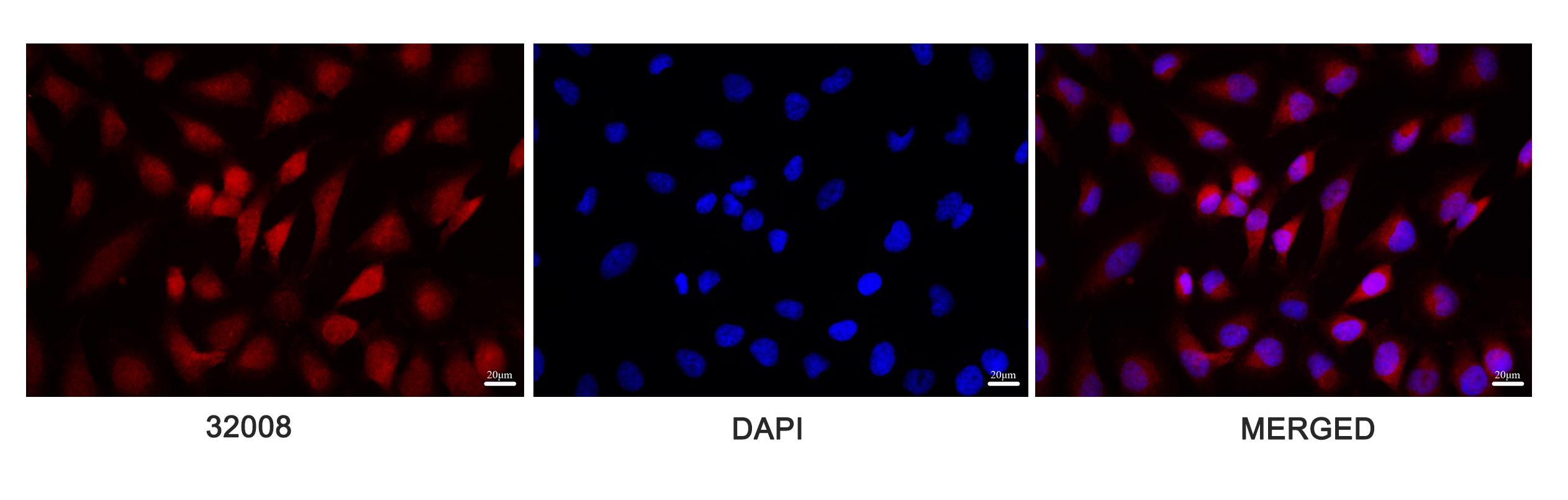 ATF6 Antibody