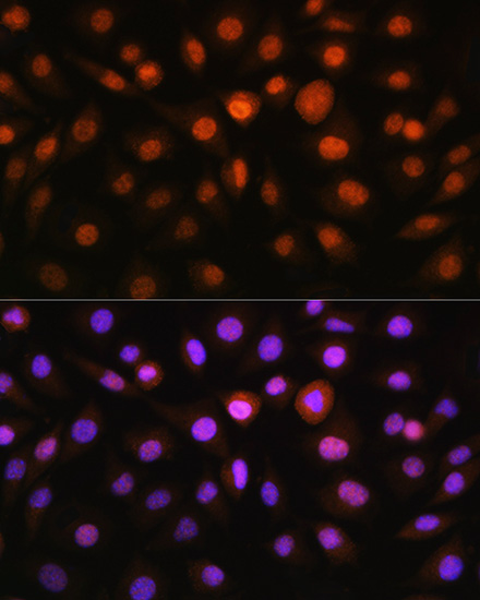 DDIT3 Antibody