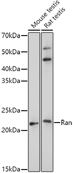 RAN Antibody