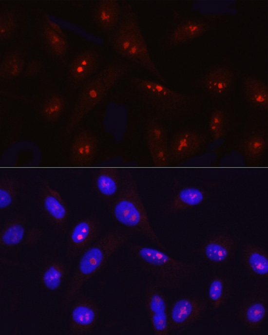 SIRT7 Antibody