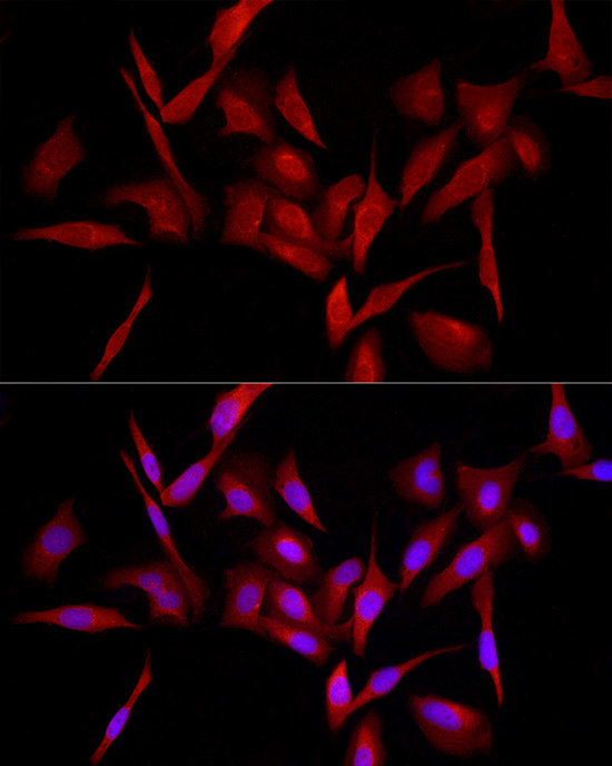 MyD88 Antibody