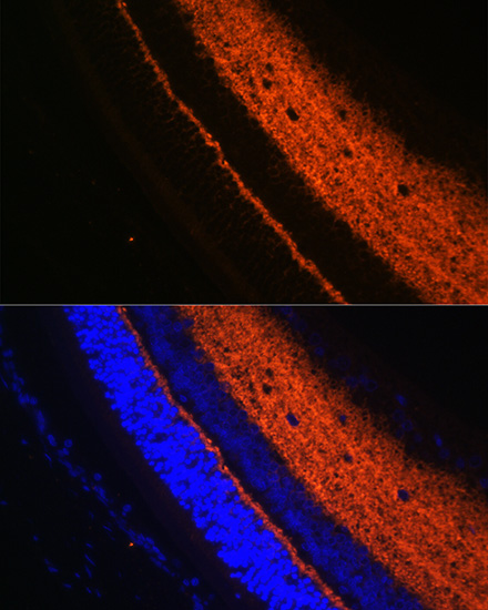 SYT1 Antibody