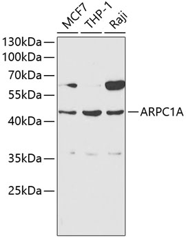 ARPC1A Antibody