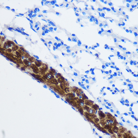 PPP1CB Antibody