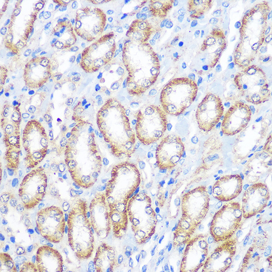 FCGR1A Antibody