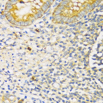 TGFBR2 Antibody