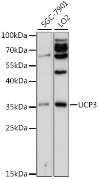UCP3 Antibody