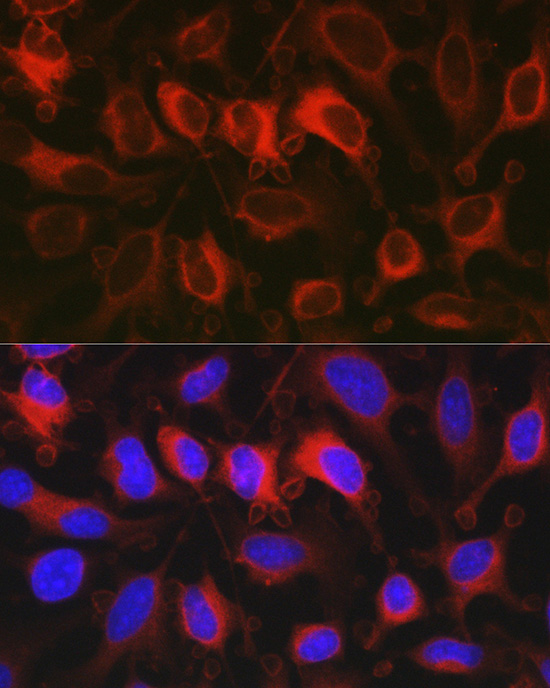 G6PD Antibody