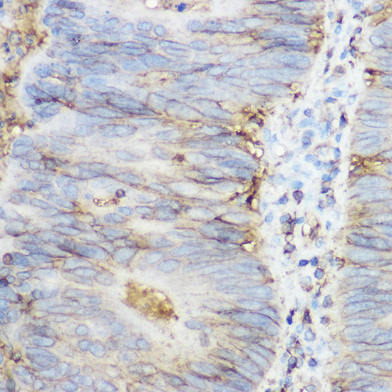 B2M Antibody