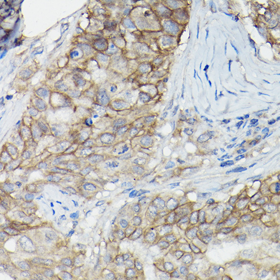BSG Antibody