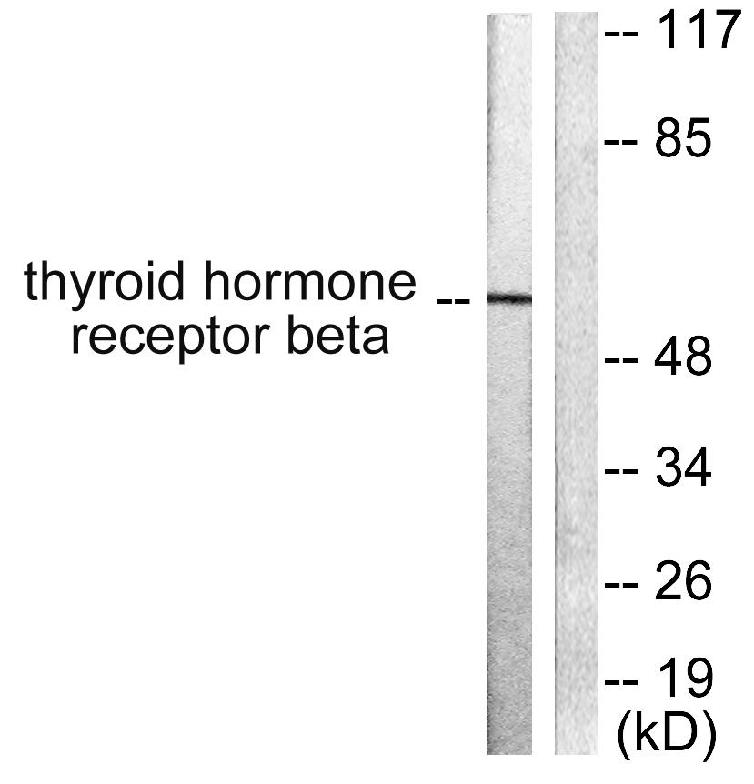 THRB Antibody