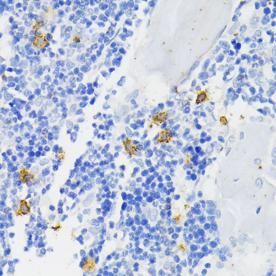CYBB Antibody