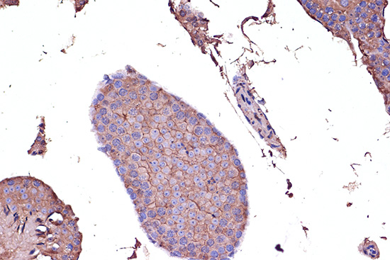 CD274 Antibody