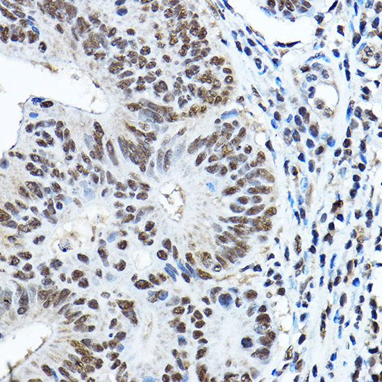 PAX3 Antibody