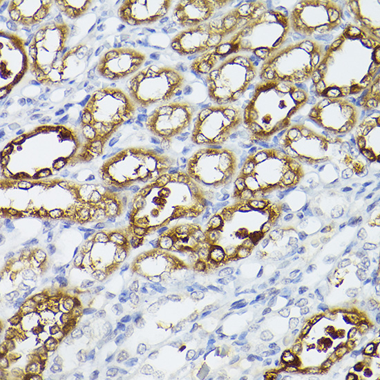 ALDH1A1 Antibody