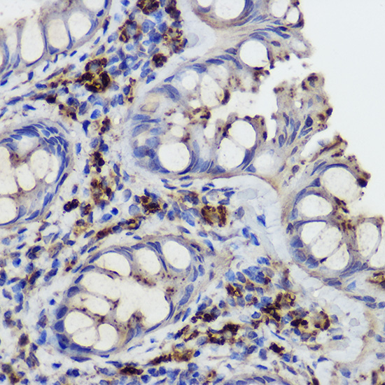 GLB1 Antibody