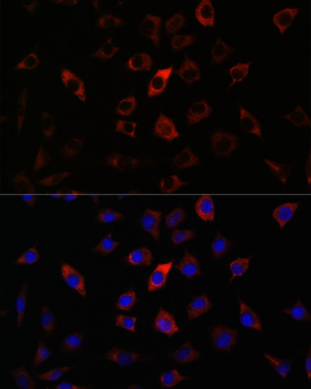 RAB27A Antibody