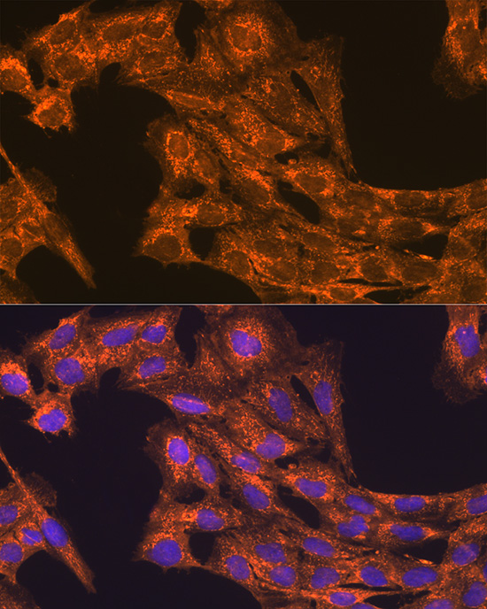 VEGFB Antibody