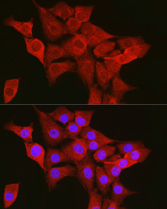TTK Antibody