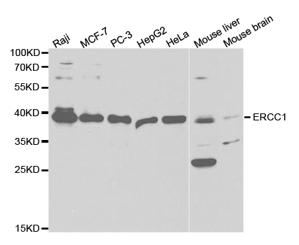 ERCC1 Antibody