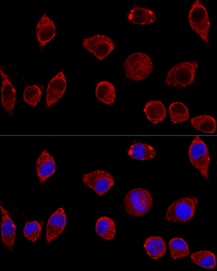DAO Antibody