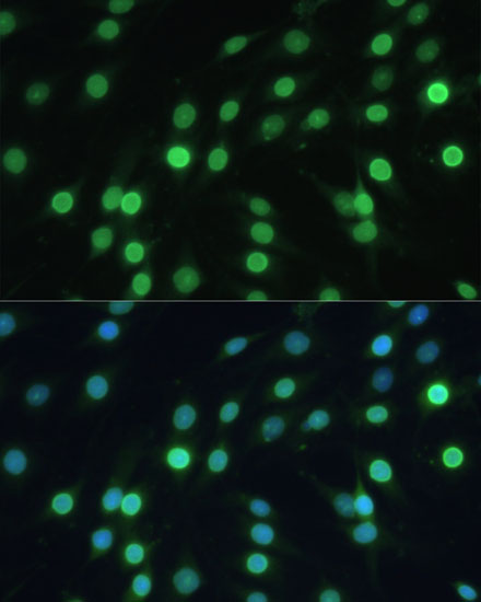 LBR Antibody