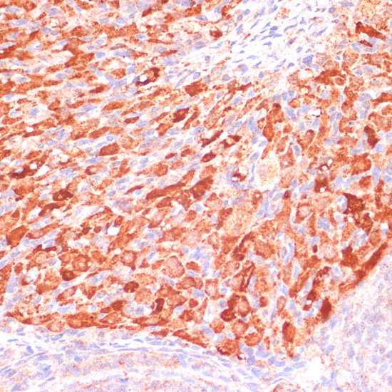 ASNS Antibody