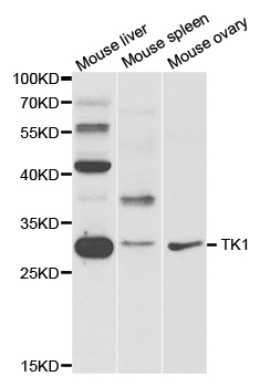TK1 Antibody