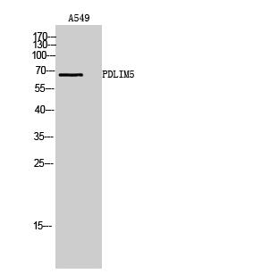 PDLIM5 Antibody