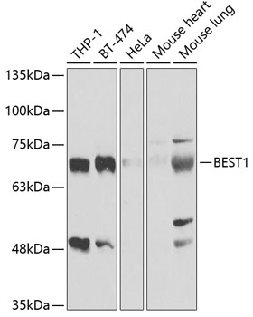 BEST1 Antibody