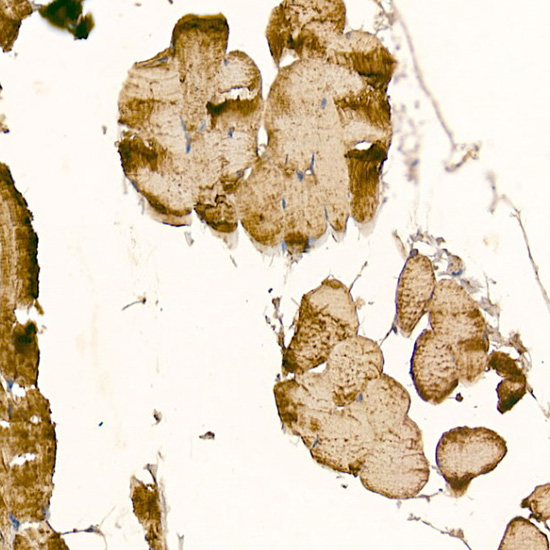 CLCN1 Antibody