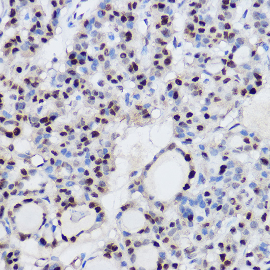 EZH2 Antibody