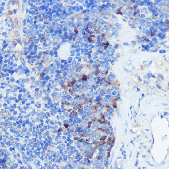 IFNGR1 Antibody