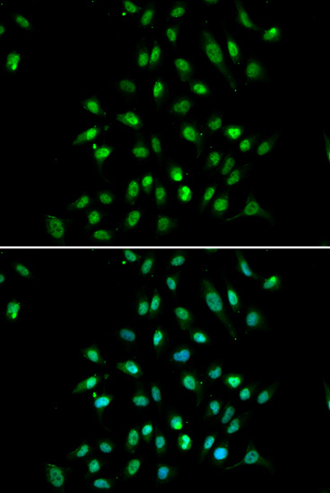 CXXC1 Antibody