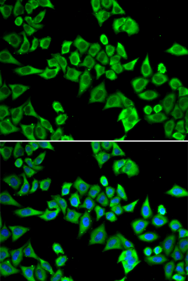 DDX20 Antibody