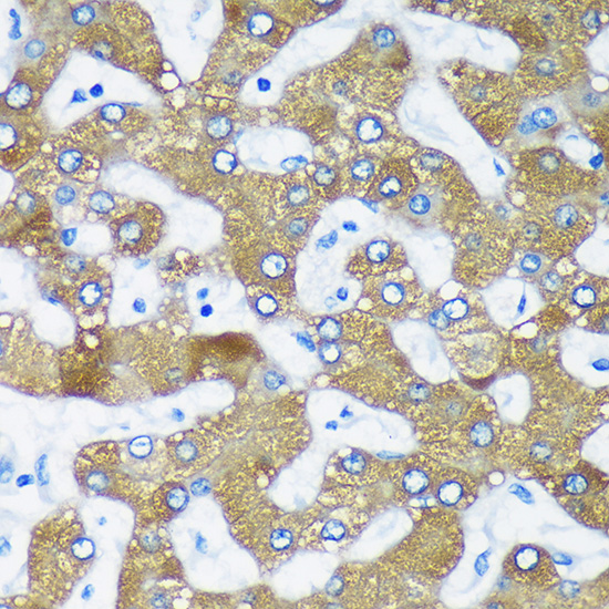 FAM82A2 Antibody
