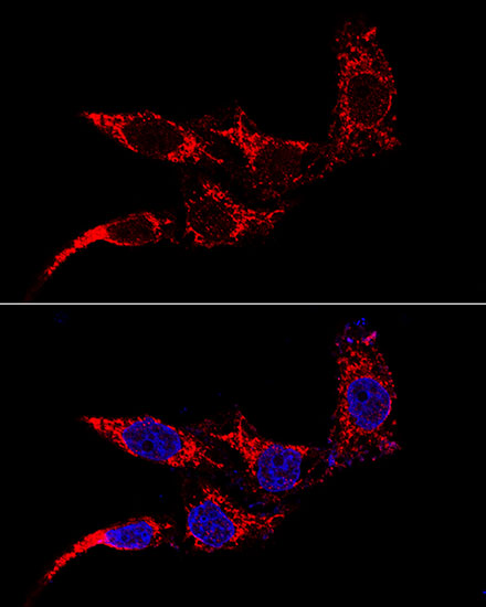FIS1 Antibody