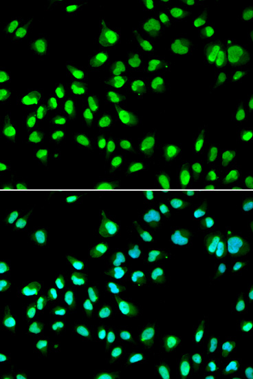 GTF2F2 Antibody